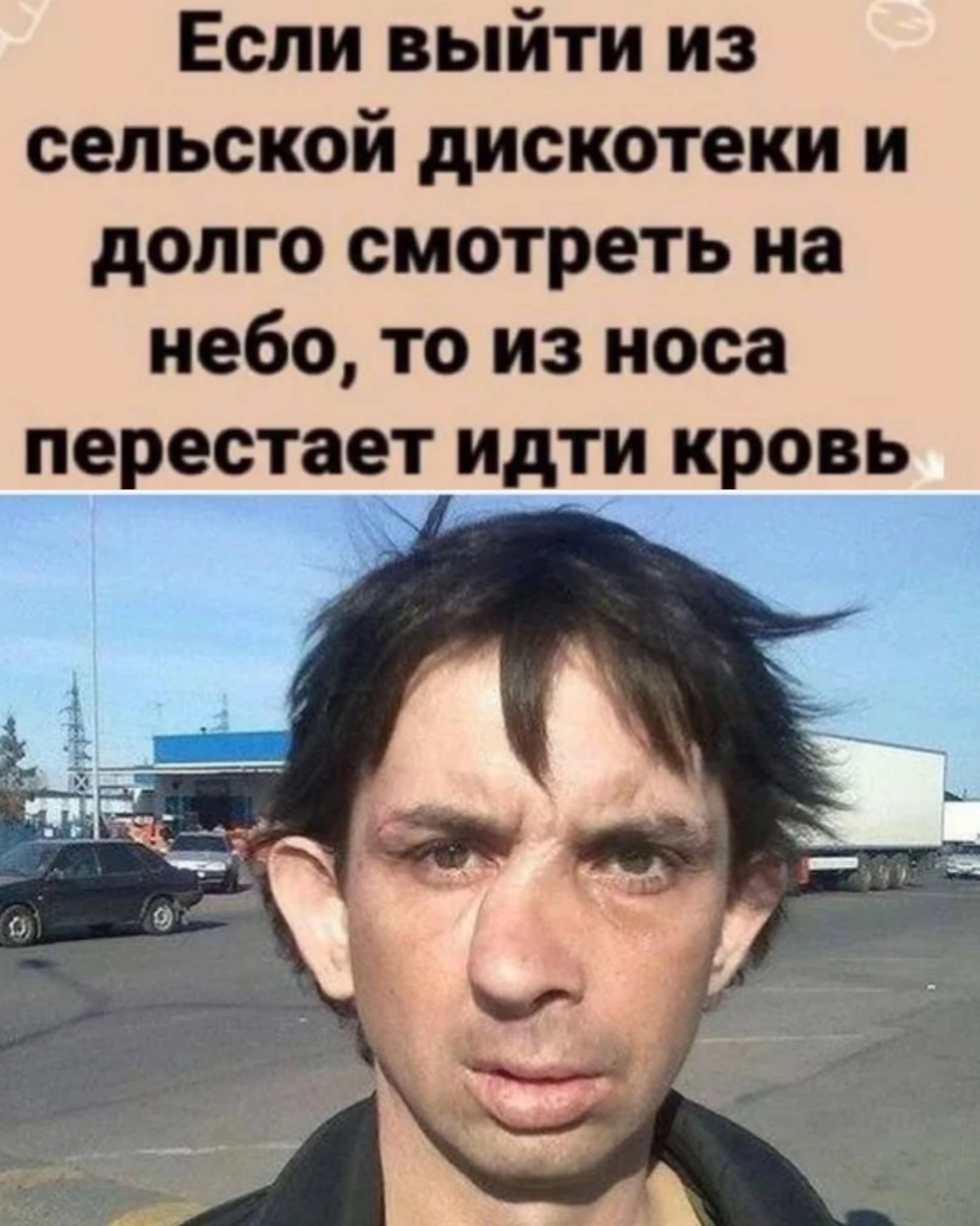 Если выйти из сельской дискотеки и долго смотреть на небо, то из носа перестанет идти кровь.